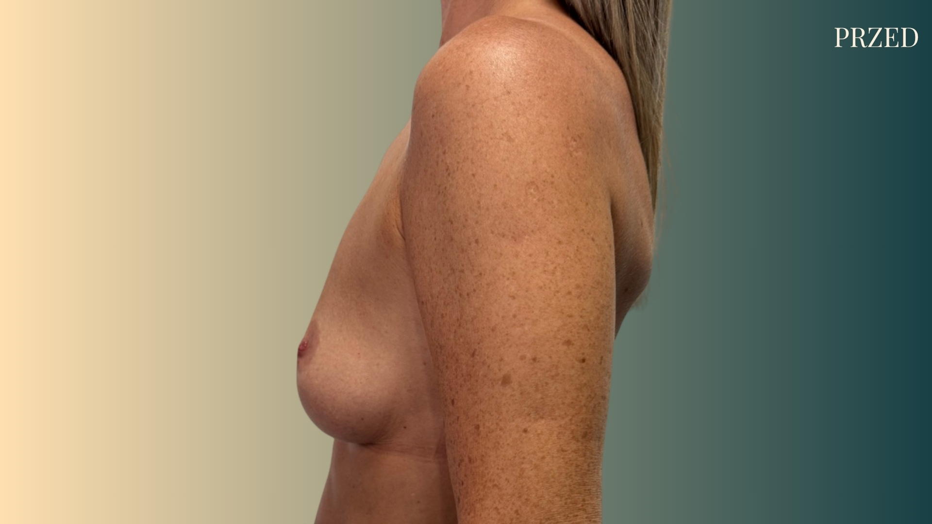 49