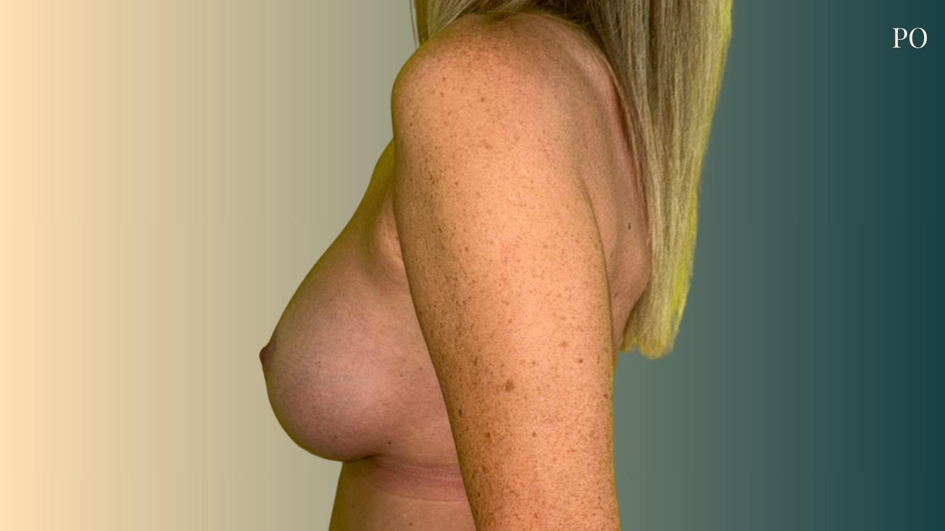 50