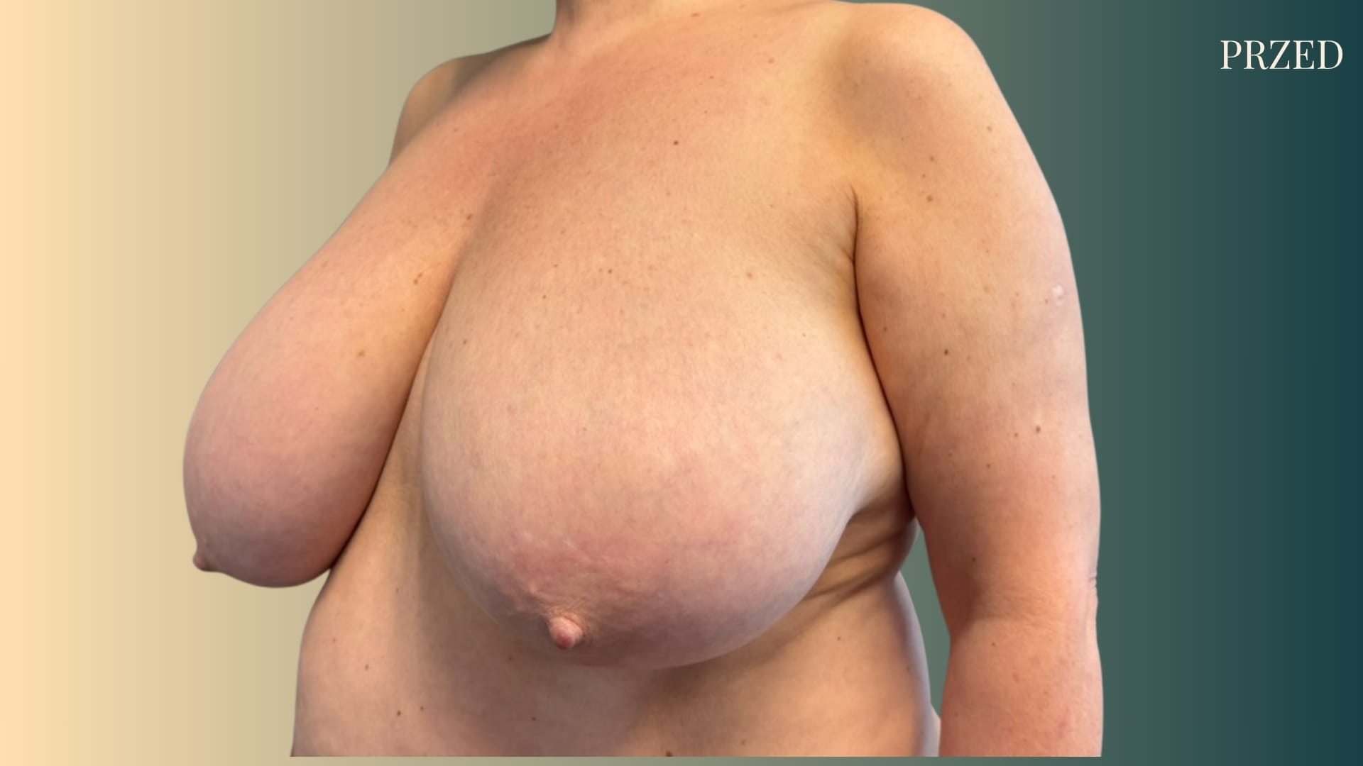 39 (1)